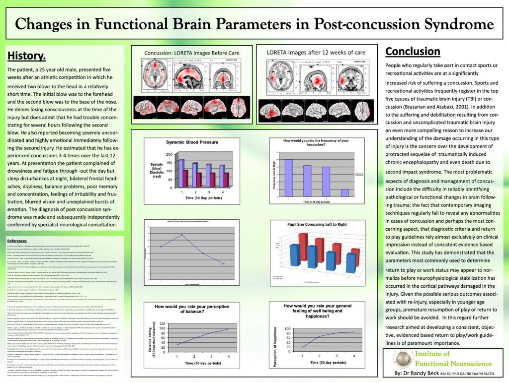 POST-CONCUSSION-SYNDROME | The Institute of Functional Neuroscience